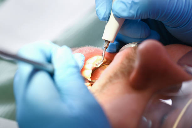 Best Chipped Tooth Repair Near Me  in Sixteen Mile Stand, OH