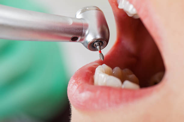 Best Tooth Pain Emergency Relief  in Sixteen Mile Stand, OH